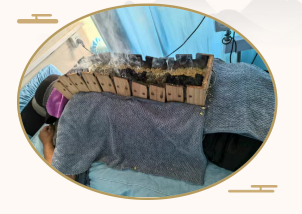 “灸中之王”督脉灸，今年您做了吗？
